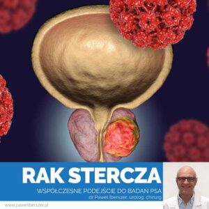 Rak stercza - badania PSA, dr Paweł Iberszer, chirurg Lublin, urolog Lublin, COZL, na zdjęciu nowotwór prostaty