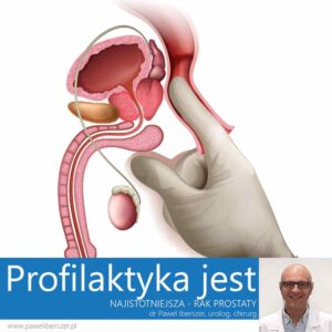 Rak prostaty - profilaktyka, dr Paweł Iberszer, chirurg Lublin, urolog Lublin, COZL, schemat badania per rectum
